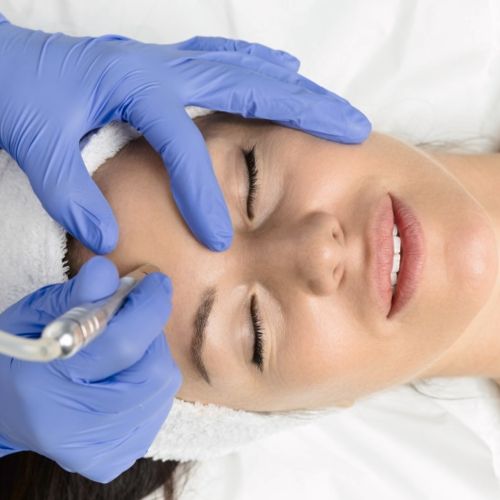 Microdermabrasion + Ultraschall